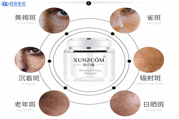 如何有效祛斑？祛斑的關(guān)鍵是什么-歐泉生化