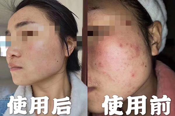 精油能喝嗎？不是所有精油都能喝-歐泉生化